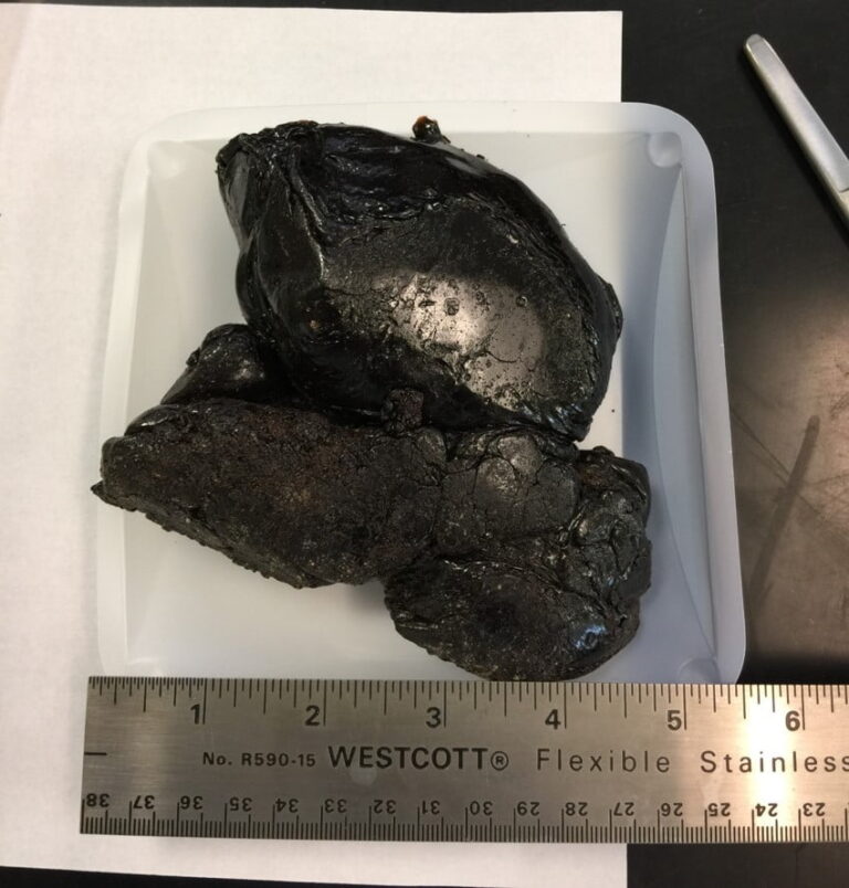 black-tar-heroin